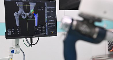 Nową terapię dla pacjentów chorobą zwyrodnieniową stawów opracowali naukowcy z Uni-54247